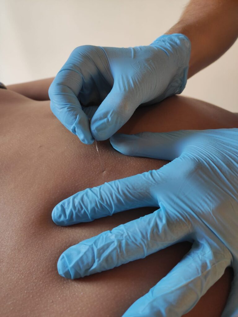 Fisioterapia en Sa Pobla